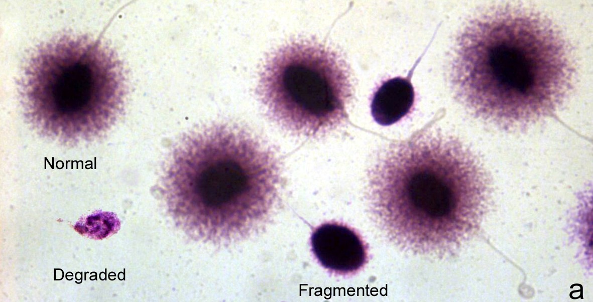 Detección de fragmentación del ADN espermático mediante SCD