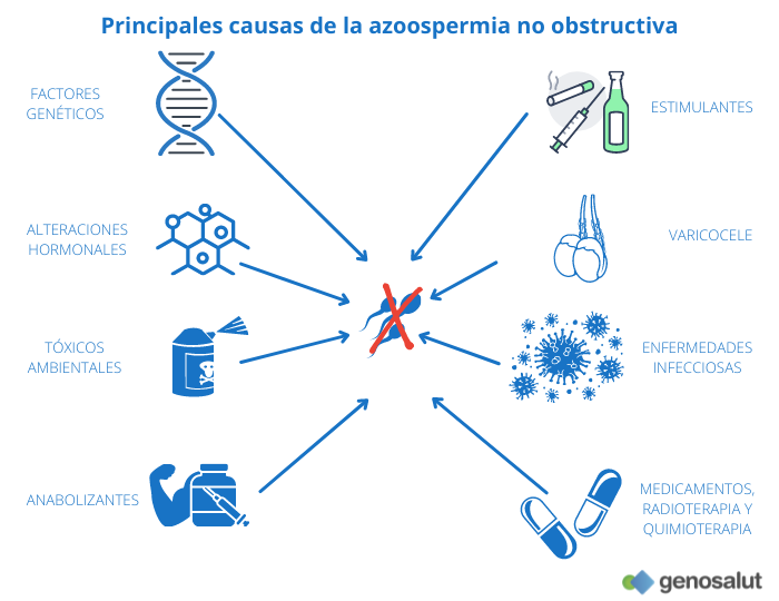 Azoospermia secretora o no obstructiva: causas